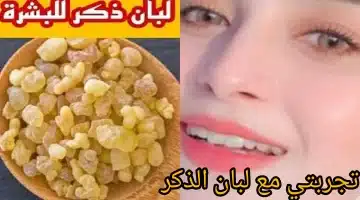 البشرة الصافية كريم لبان الذكر والنشا بتركيبة الكولاجين الطبيعي