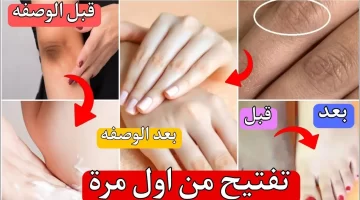 خلطة سحرية لتبييض البشرة بالمنزل وداعًا للاسمرار والبقع الداكنة