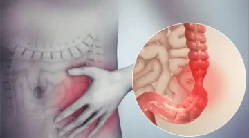 وداعًا لمشاكل الهضم العشبة الأردنية الفعّالة لتنظيف القولون في دقائق