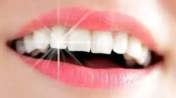 أفضل الطرق الطبيعية لتبييض الأسنان المنزل