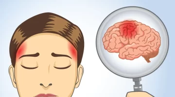 مش صداع عادي 5 إشارات خطيرة قد تنذر بأورام المخ انتبه قبل فوات الأوان 1