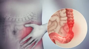 وداعًا للأدوية مشروب طبيعي قوي ينظف القولون ويخلصك من الفضلات المتراكمة بسرعة 1