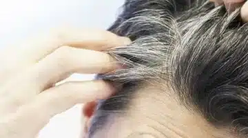 ودّعي الشيب المبكر بوصفات طبيعية فعّالة وآمنة تدوم طويلًا