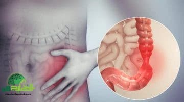 أسرار الطبيعة لتنظيف القولون 3 أعشاب سحرية تخلصك من الإمساك وانتفاخ البطن دون أدوية