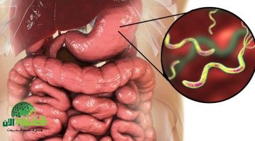 جرثومة المعدة . الدليل الشامل للعلاج الطبيعي والوقاية الذكية1
