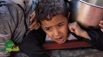 أزمة غزة الإنسانية . الجوع يهدد الأطفال1